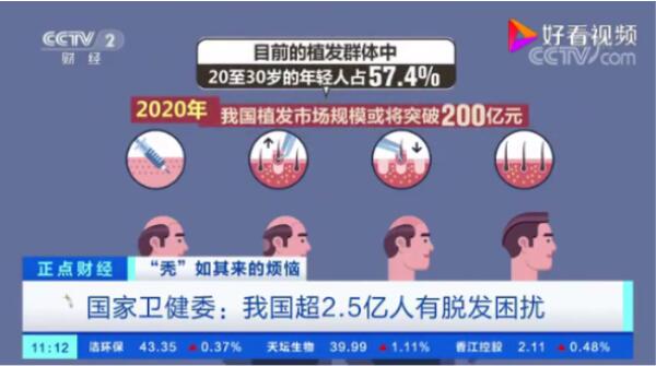 脱发成全球焦虑 国外友人更青睐中国植发机构