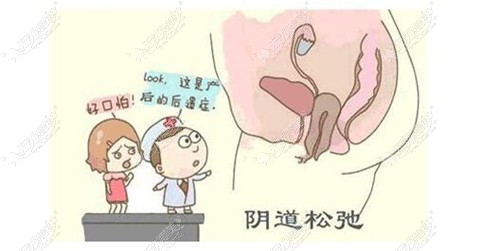 阴道松弛做脂肪填充缩阴效果也不错 阴道松弛做脂肪填充缩阴效果也不错