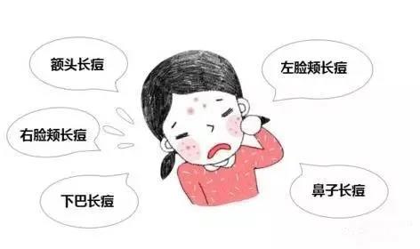 脸上冒痘怎么办？脸上不同位置冒痘卡通图片