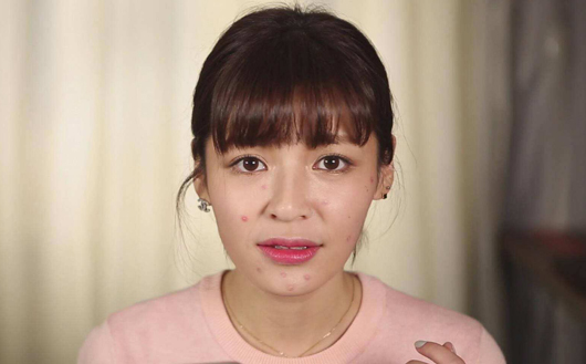 脸上冒痘多半是这几个原因(图1) 脸上冒痘怎么办?脸上冒痘女生图片