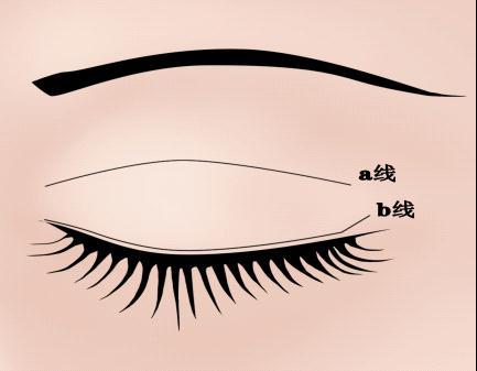 双眼皮成型术有哪些好处？术后如何保养？(图1)