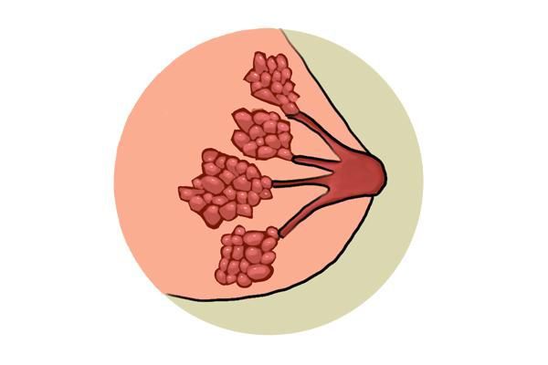 女子花近50万隆胸，不到一年查出乳腺癌，隆胸的四大风险，别忽视(图4)