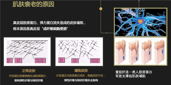 重组Ⅲ型胶原蛋白：美尚洁生物 打造新一代美容抗衰“神器”(图4)