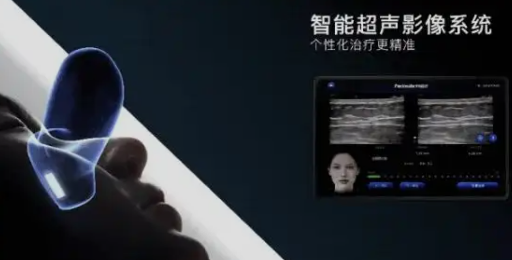 港女偏爱国产超声抗衰的理由