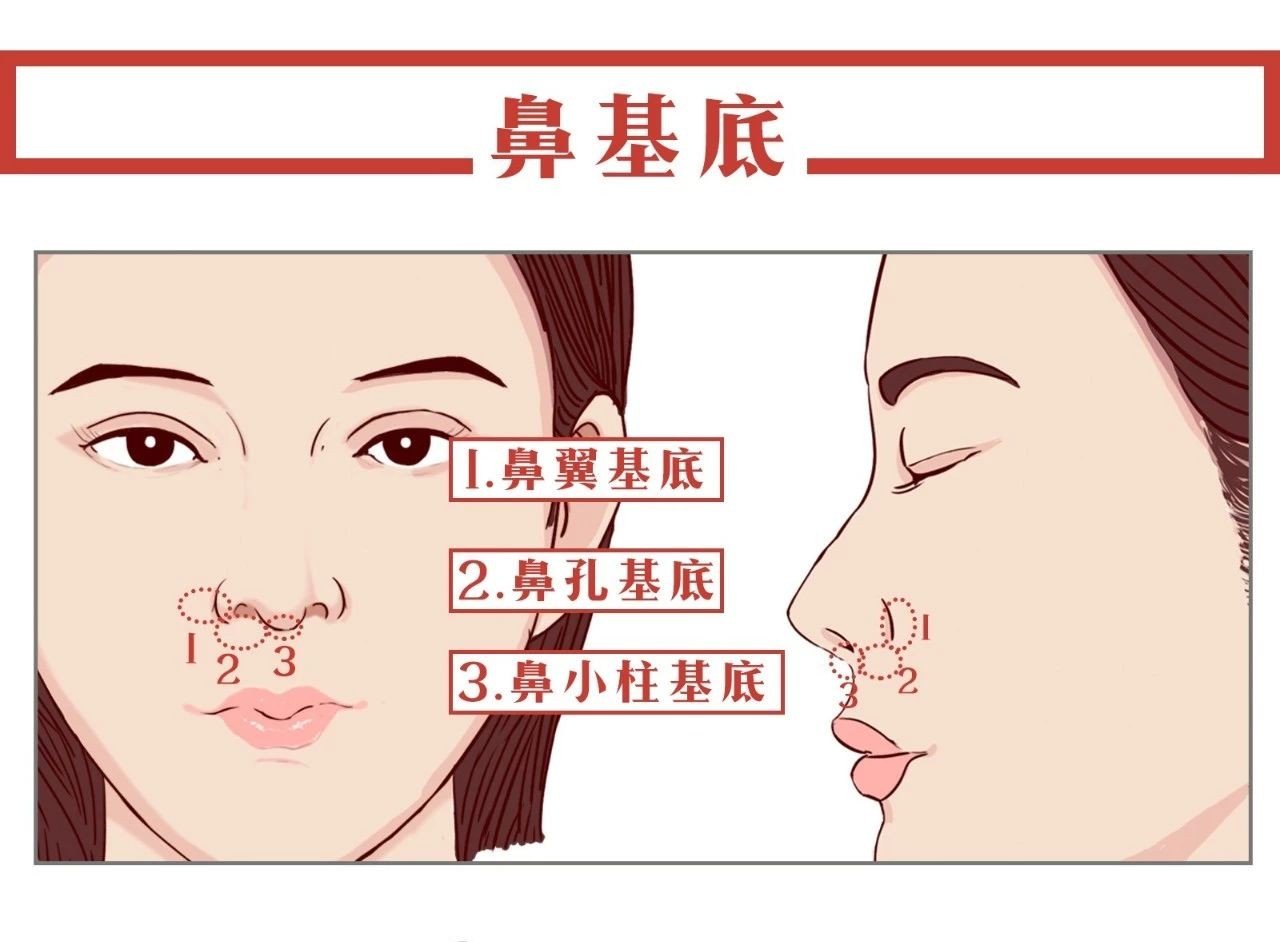 拉皮可以剥离到鼻基底吗？(图1)