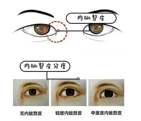 揭秘不同眼型，拥有迷人双眸的整形方法(图2)