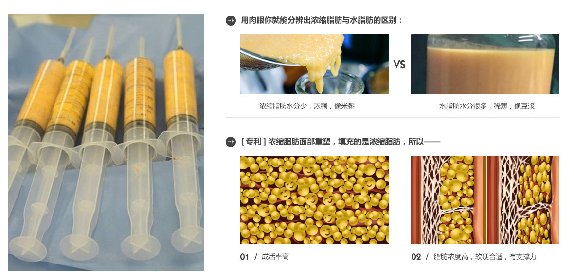 专利浓缩脂肪和普通水脂肪为何差距会这么大?(图1)