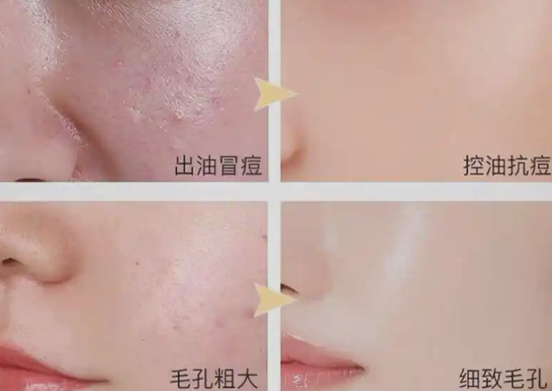 收缩毛孔的护肤品有哪些?(图1) image.png